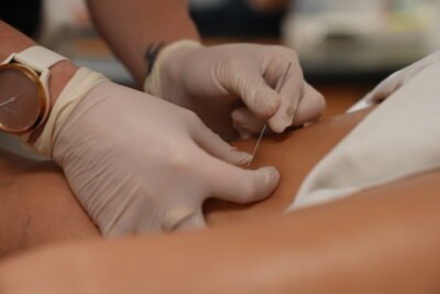Needling Therapy | BYoung Physical Therapy Needling Therapy